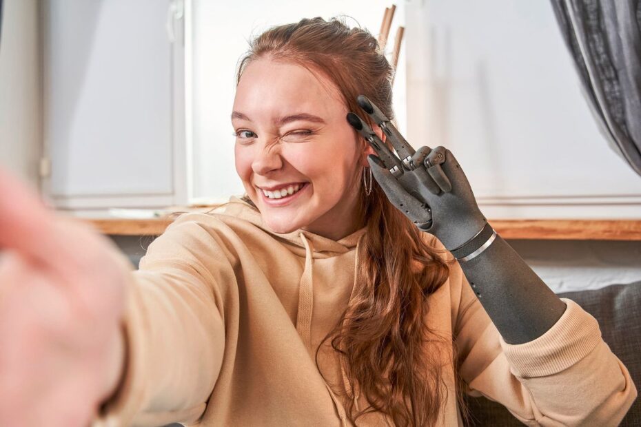 Український протез Esper Hand потрапив у рейтинг найкращих винаходів