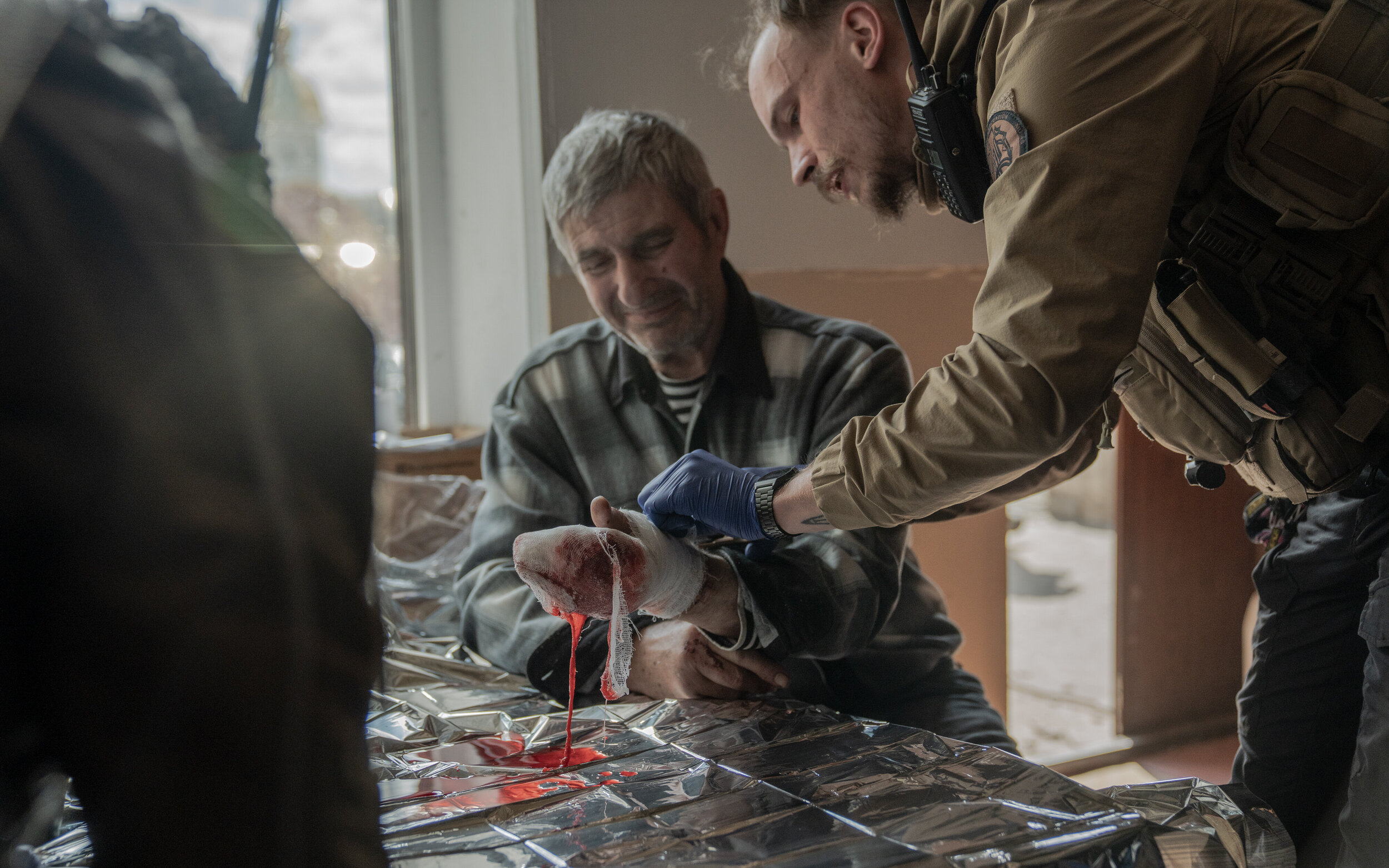 vovchansk russians shot off his finger