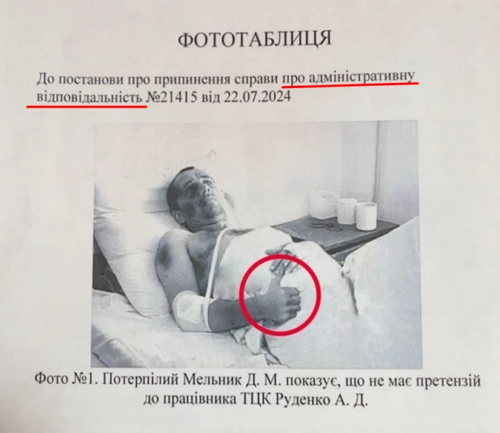 зображення до посту: Фейк. У Харкові «зам’яли» справу про побиття чоловіка співробітником ТЦК