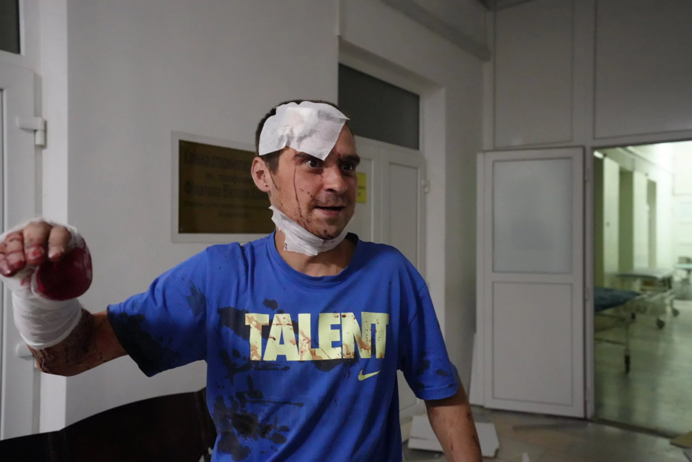 зображення до посту: “Entire hospital room is bloodied.” Russia bombarded Kharkiv, damaging hospital, residential buildings, injuring 36, including 5 children (in photos)  