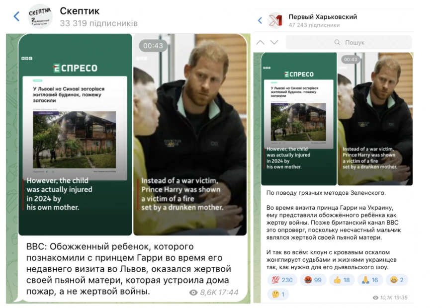 зображення до посту: Фейк. Хлопчик з опіками, з яким поспілкувався принц Гаррі, отримав їх внаслідок побутової пожежі