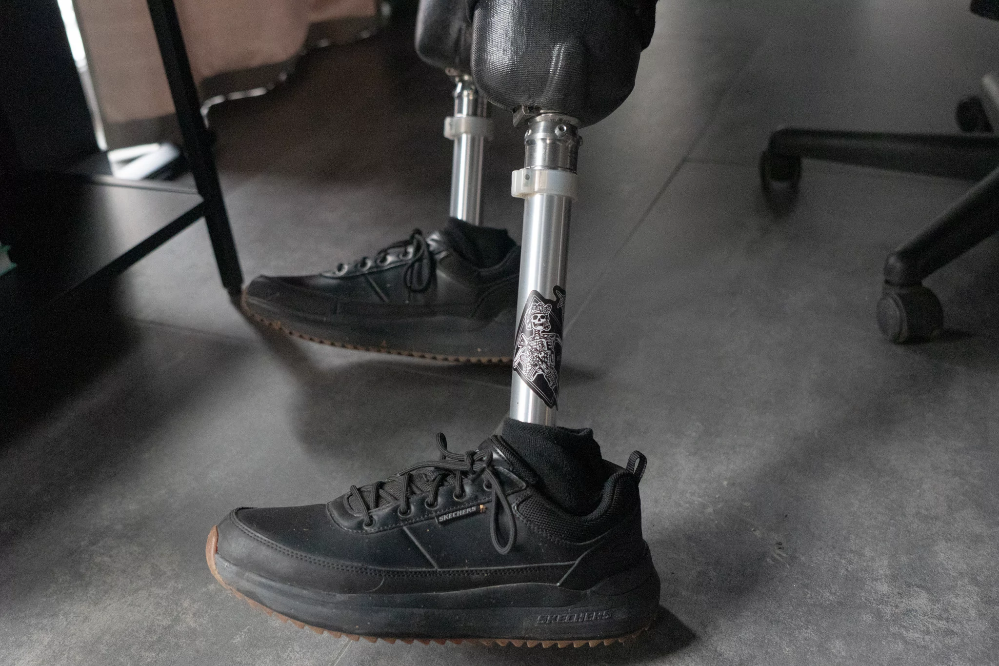 Kostiantyn's prosthesis