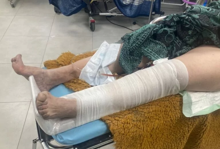 Російський FPV-дрон атакував харків’янку в Дергачівській громаді