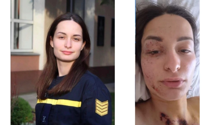 «Пів мільйона за добу»: українці підтримали поранену у Харкові рятувальницю